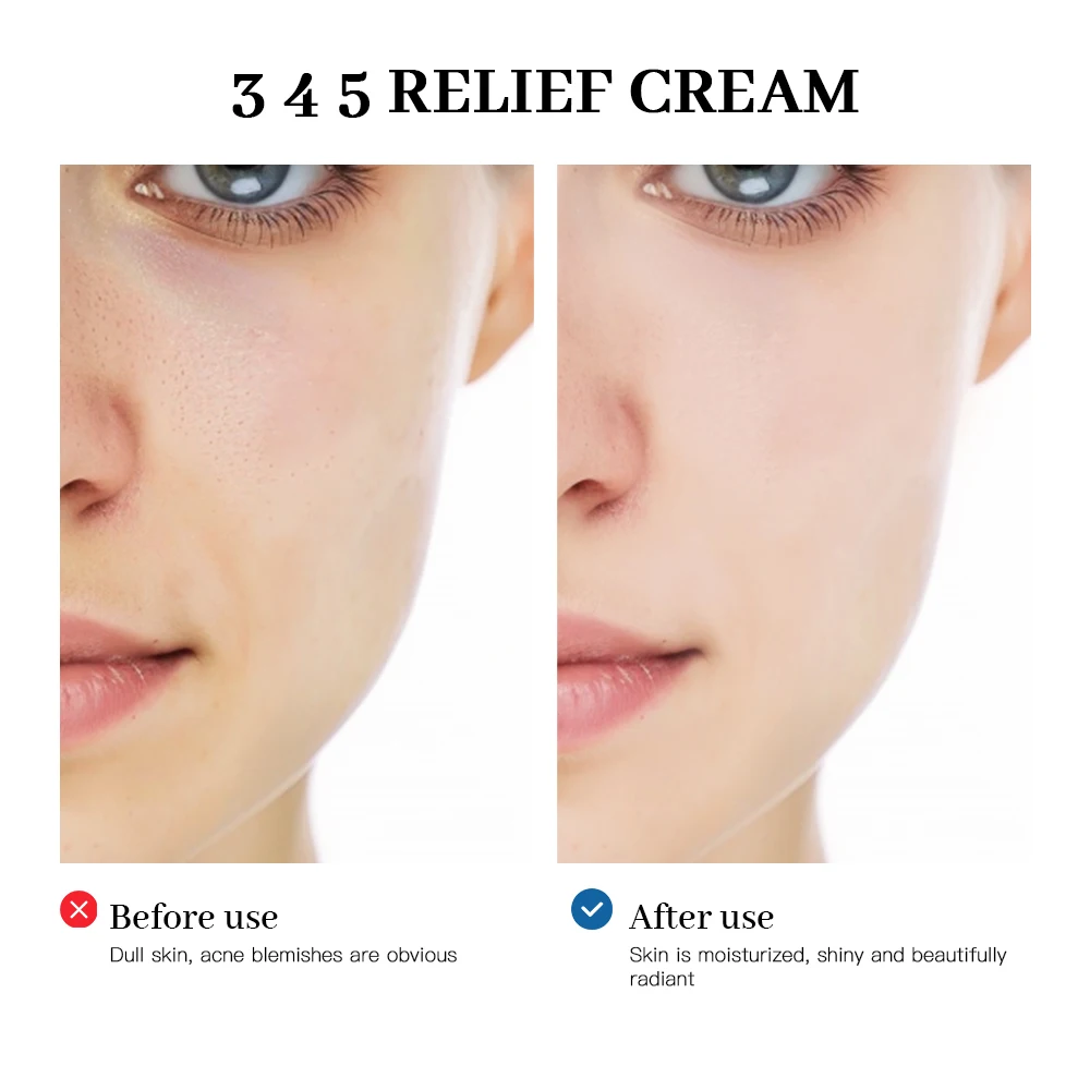 345 relief cream address blemishes nourish the skin and provide soothing care resulting in a well rounded skincare solution 345 relief cream address blemishes nourish the skin and provide soothing care resulting in a well rounded skincare solution